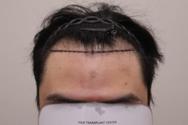 1000006044.jpg