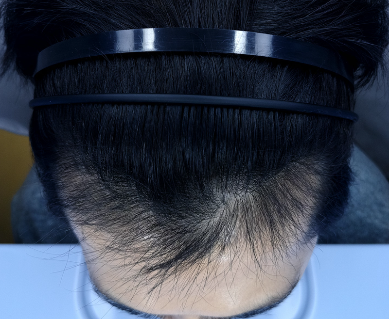 남학준95 3500모 3mo후.png
