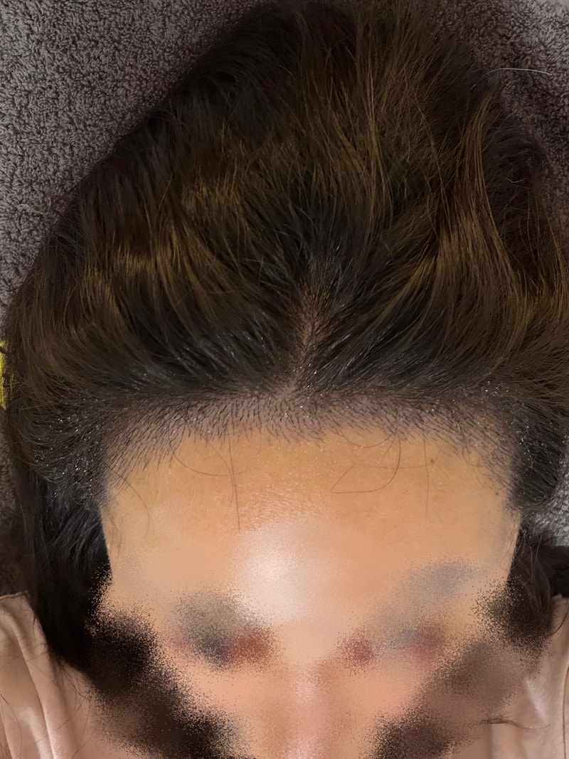 압구정 모우림의원 후기