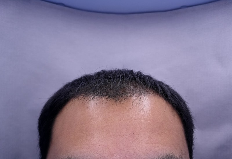 3mo (2).jpg