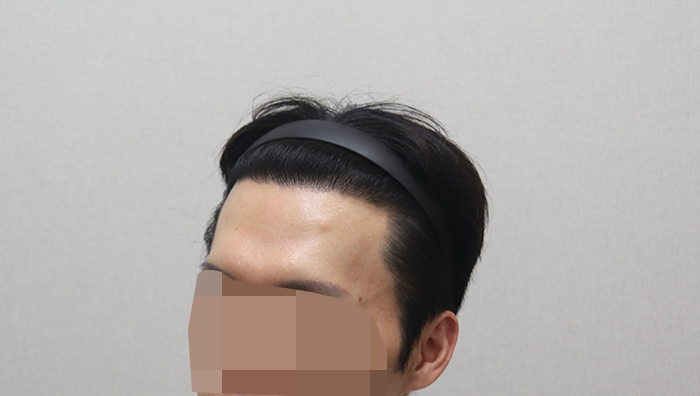 8. 최근 11개월 경과.JPG