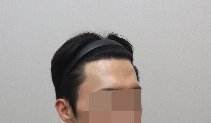 9. 최근 11개월 경과.JPG
