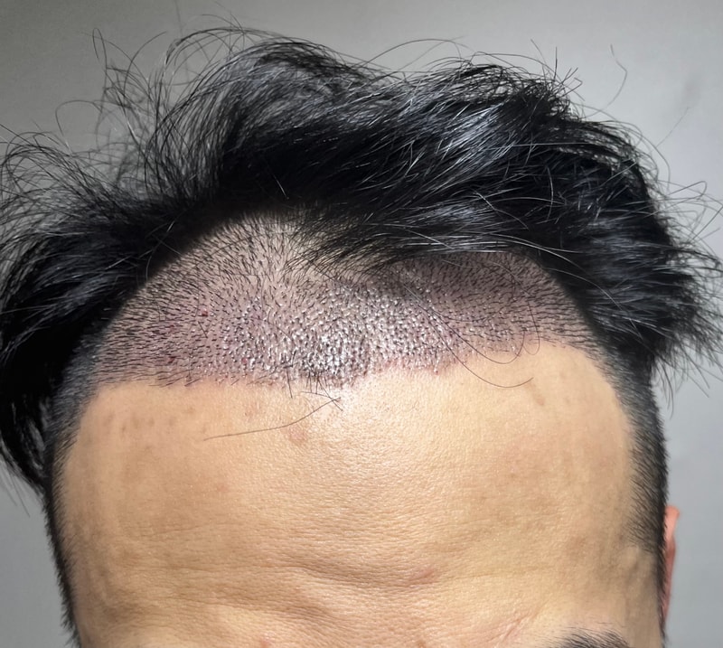 10日目の体験談です。