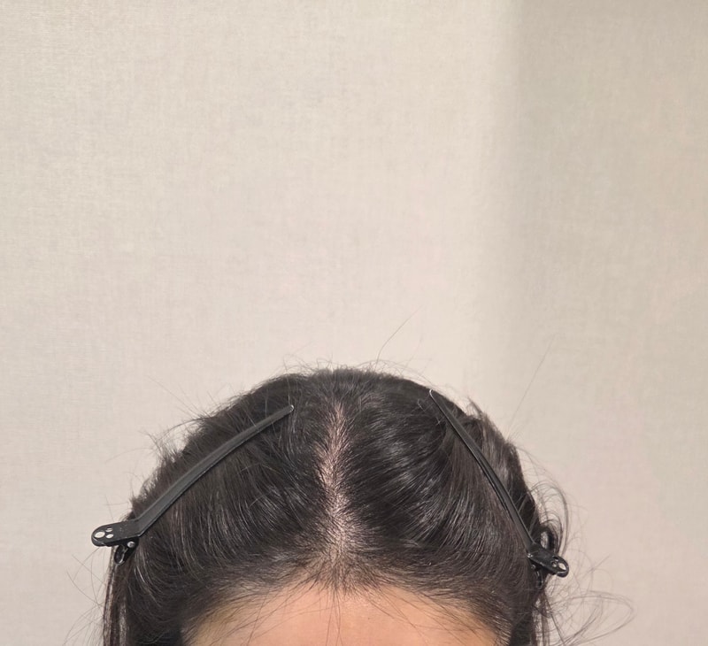 20대 여성 헤어라인