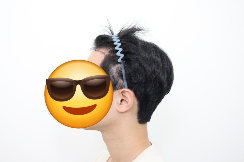 신사동 모프로의원 
