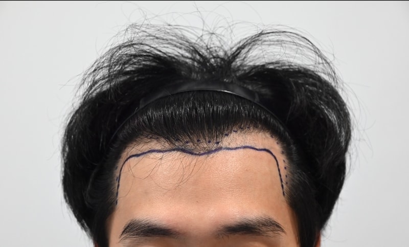 1000041003.jpg