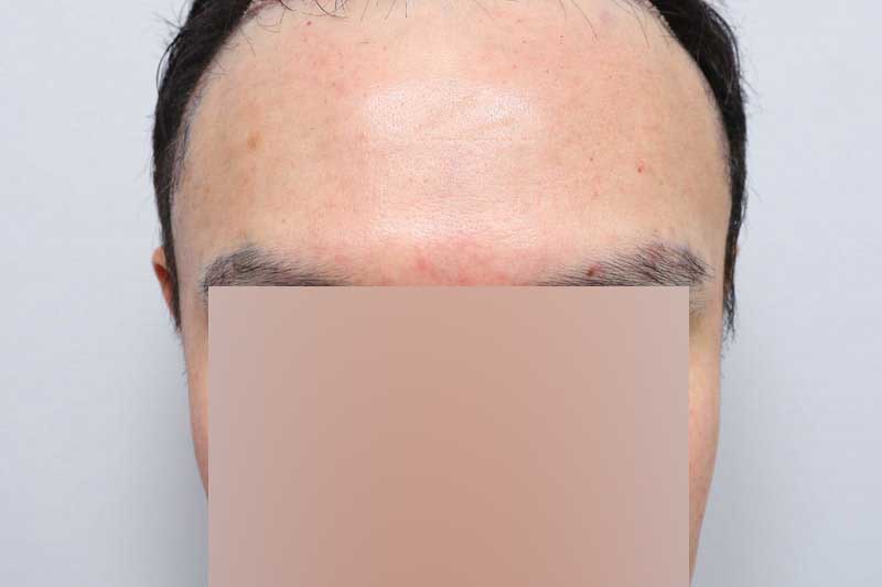 44.jpg
