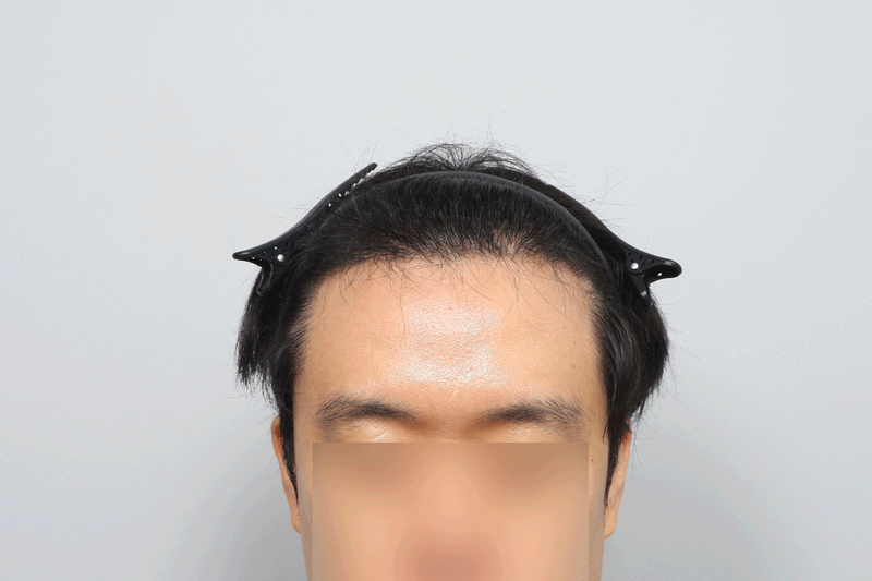 ㅈ1.gif