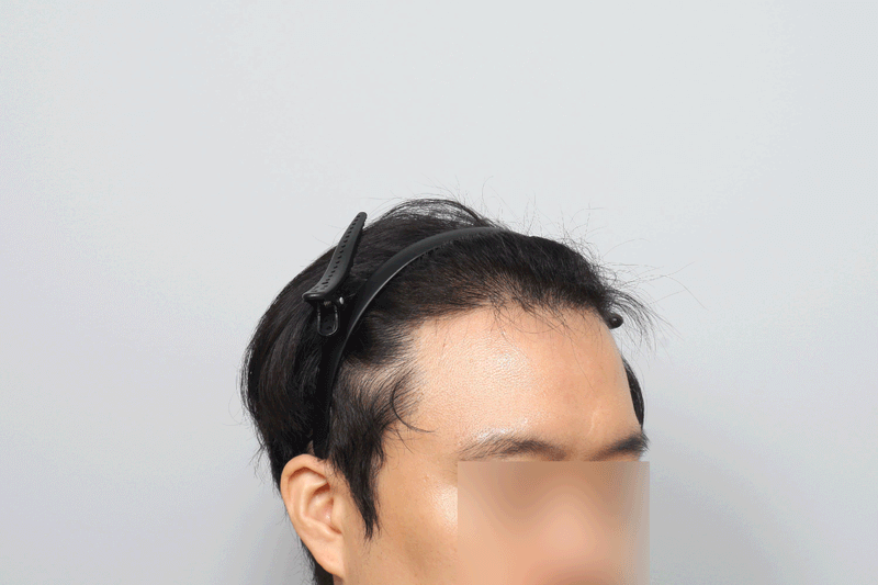 ㅈ4.gif