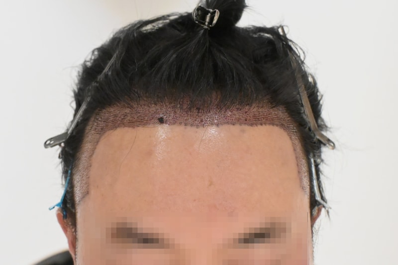 샴푸 후 디자인(정면1).jpg