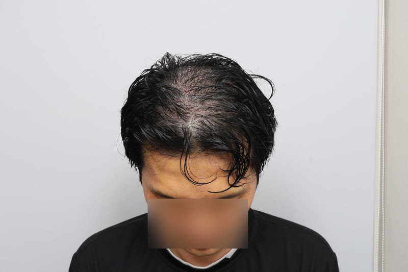 수술직후-(16).jpg