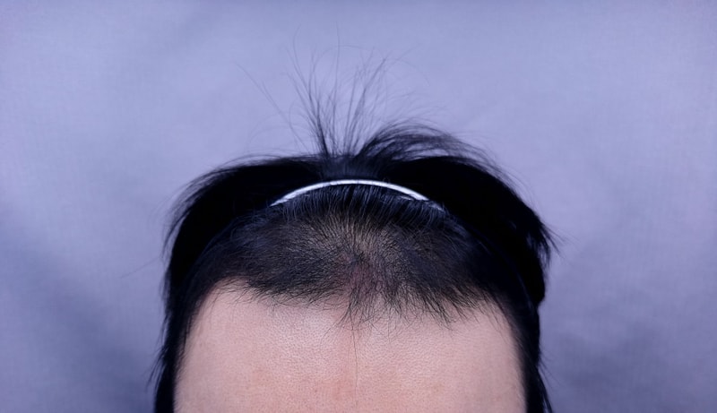 후.jpg