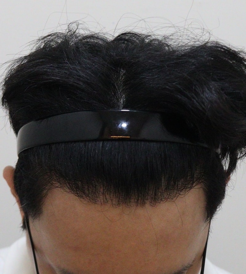 4. 수술후_1년_2.JPG