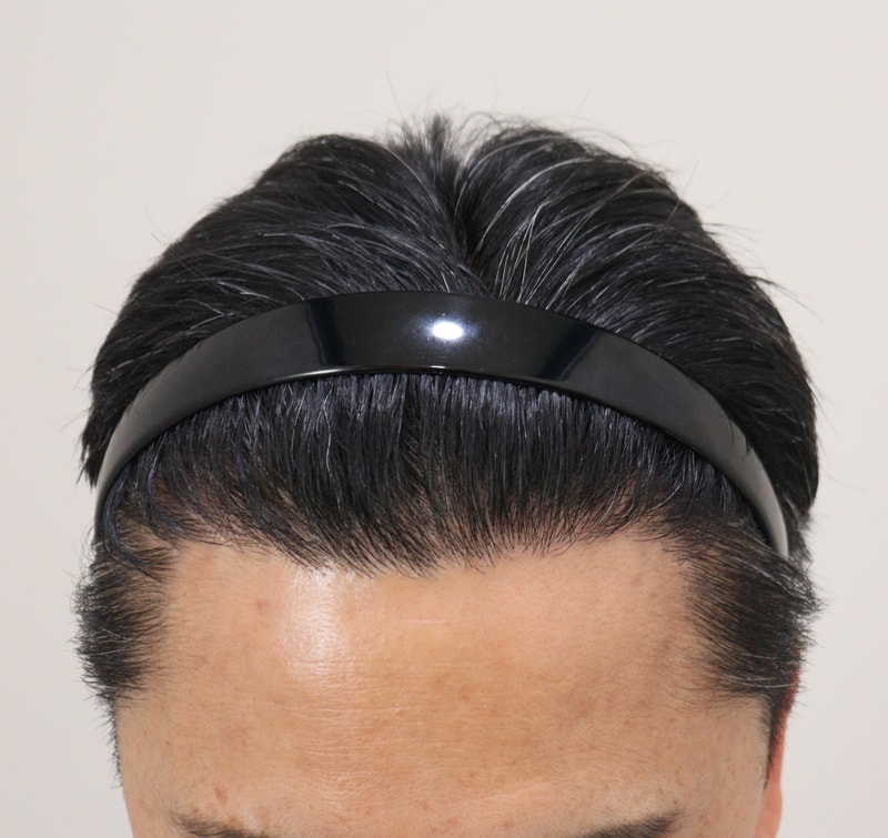 5. 수술후_1년_2.JPG