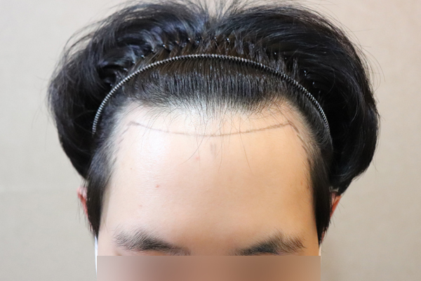 포토후기 이미지