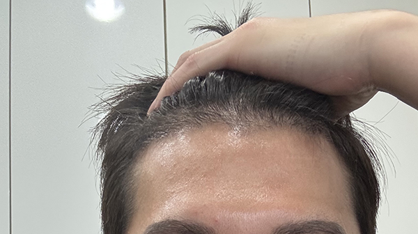 4-암흑기에 안 빠졌던 머리들이 그대로 자랐어요 머리가 빨리 기는 편이긴 한데 신기하지 않나요.jpg
