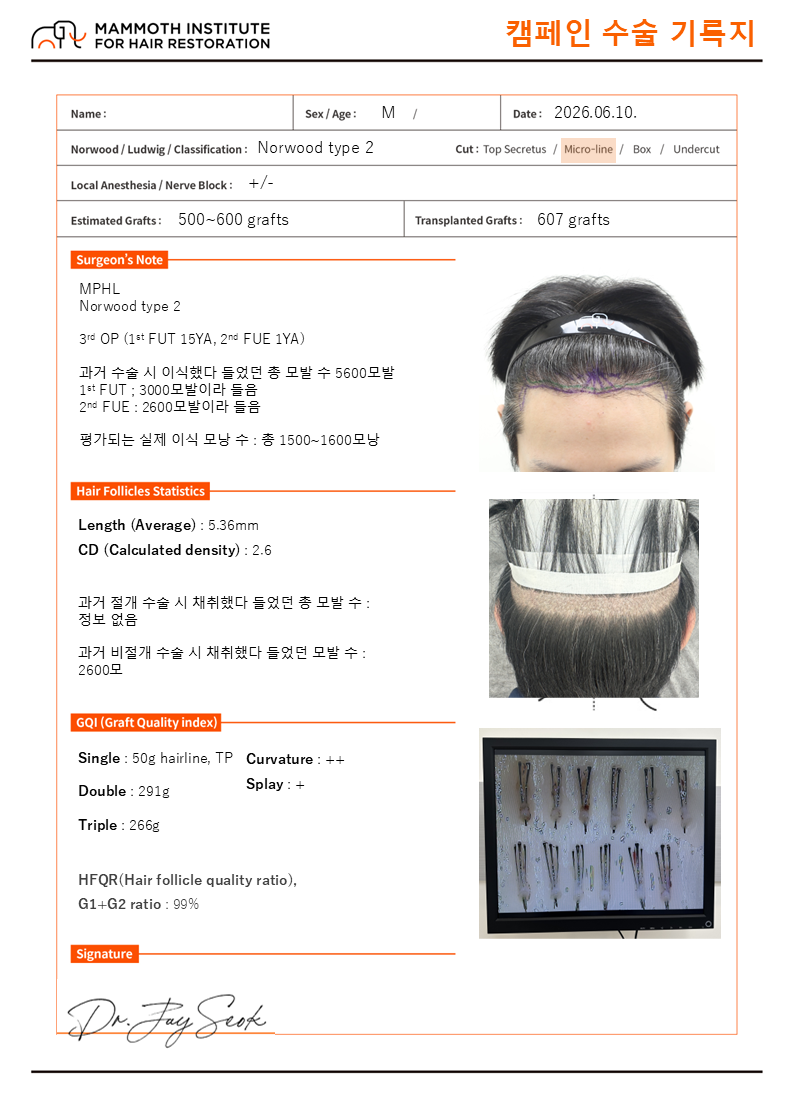 After 1st and 2nd operation failures, 3rd operation day later (Apgujeong Mammoth Hair Restoration Center hair count suppression campaign)