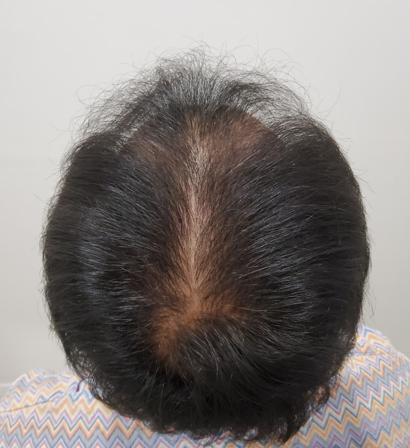 1. 수술전_3.jpg