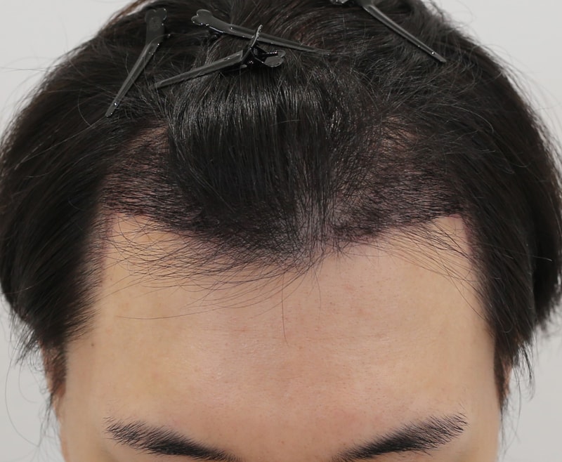 포토후기 이미지