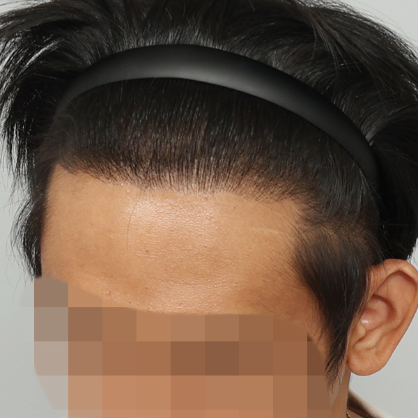 수술 후 391일차 (1).jpg