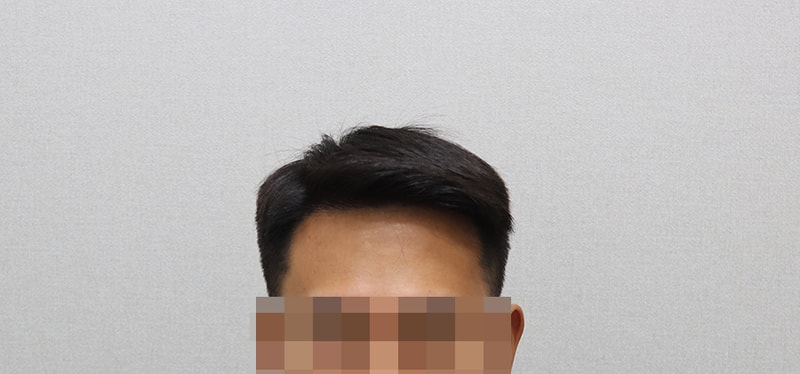 4. 1년1개월 평소 스타일 IMG_5175.JPG