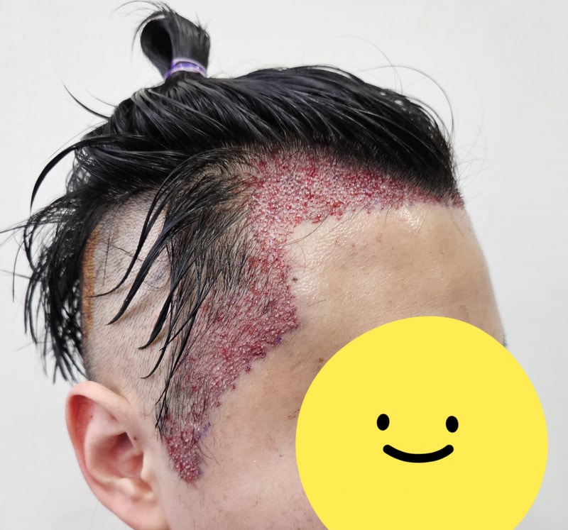 모재성 12개월차 후기