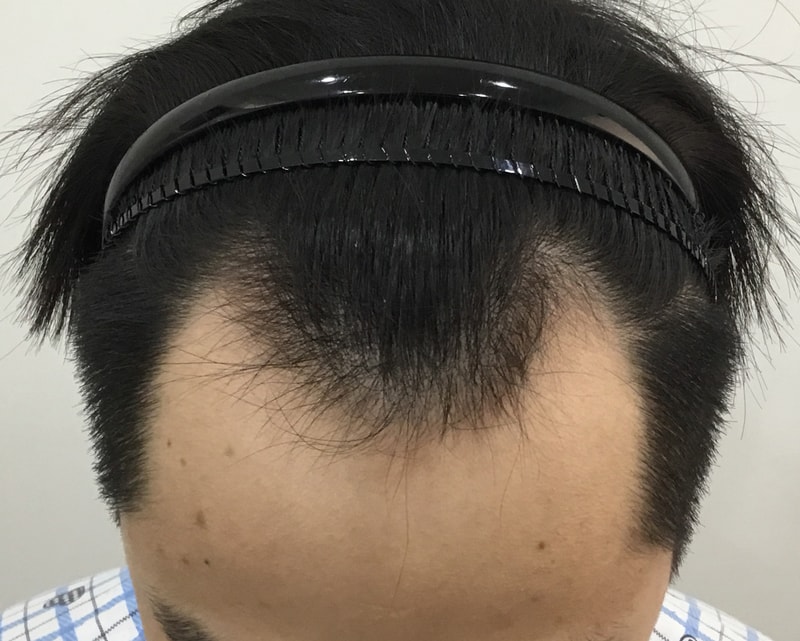 M자 3800모 10개월 후기