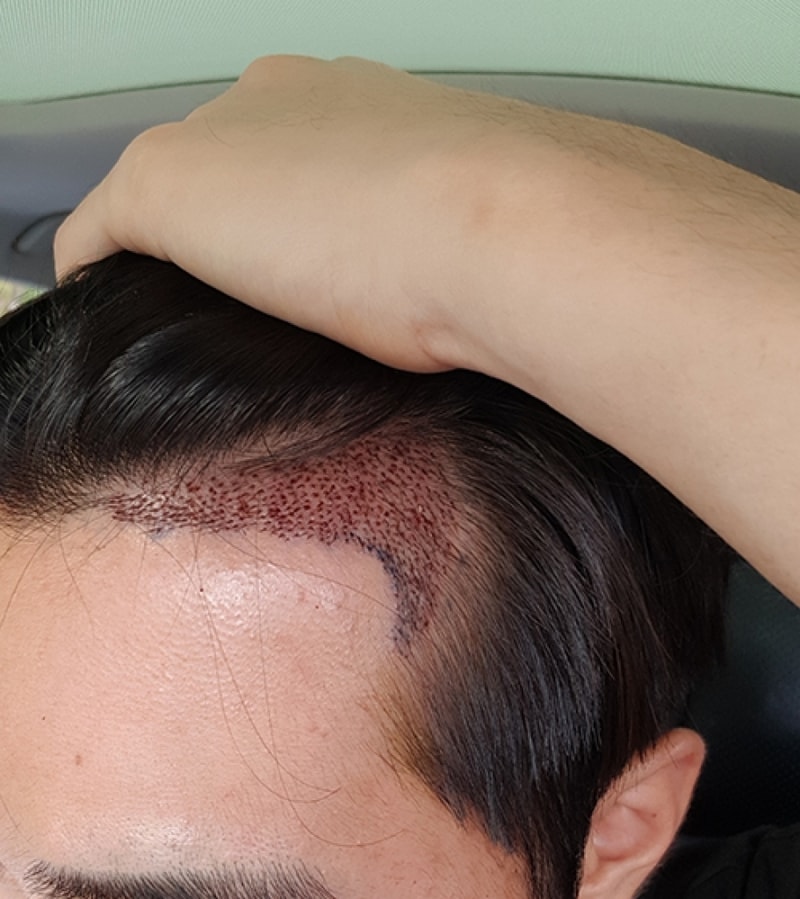 DCMI20180719666927.jpg