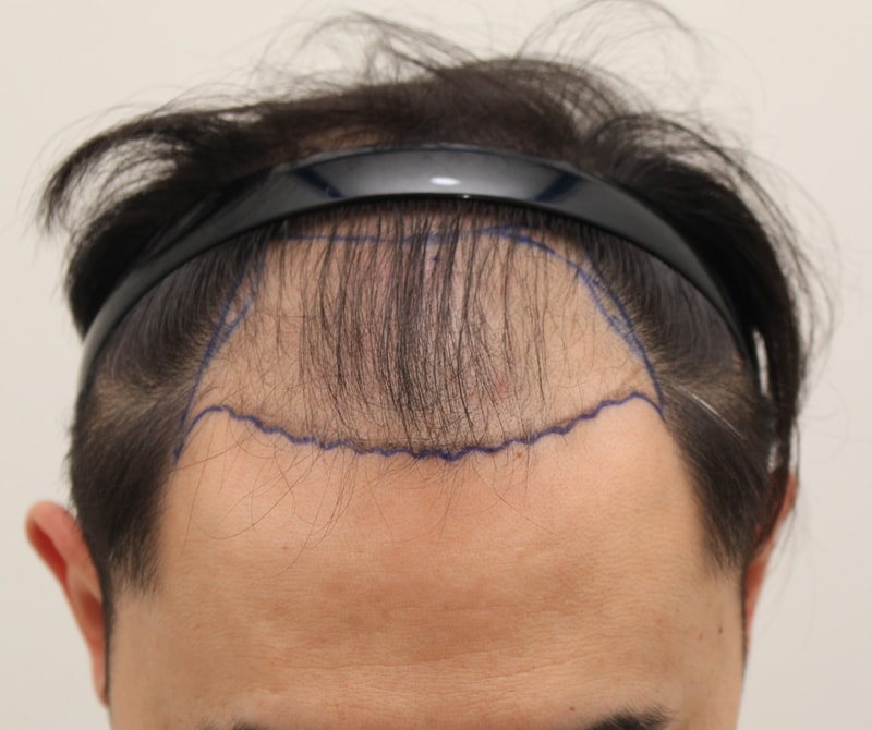 9개월차 사진 올립니다