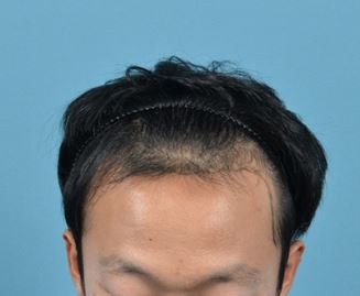 캡처.JPG