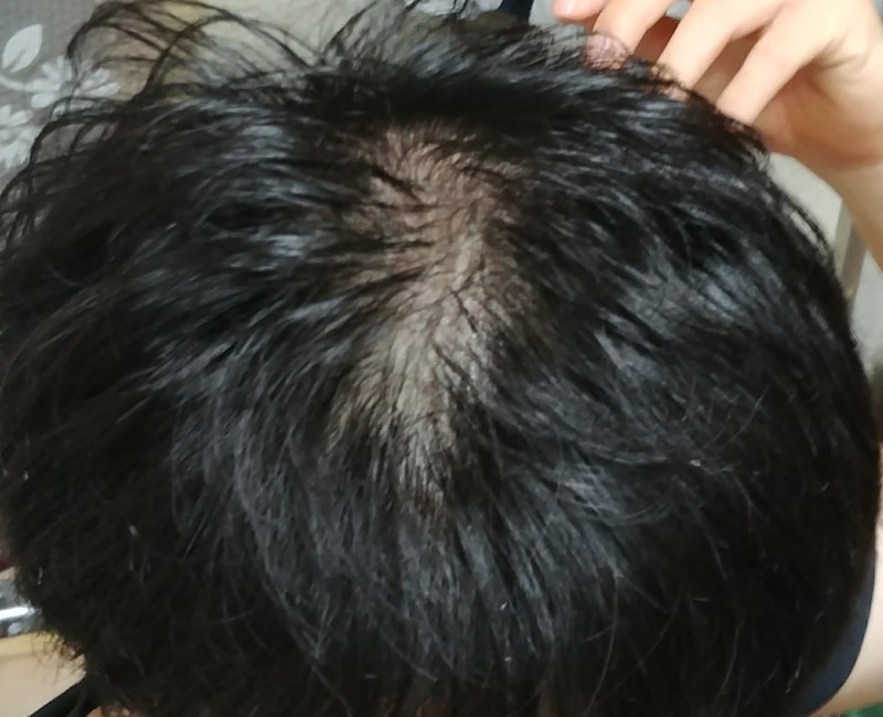 3542388273_5yeUn1Lh_20170813_001801-1.jpg