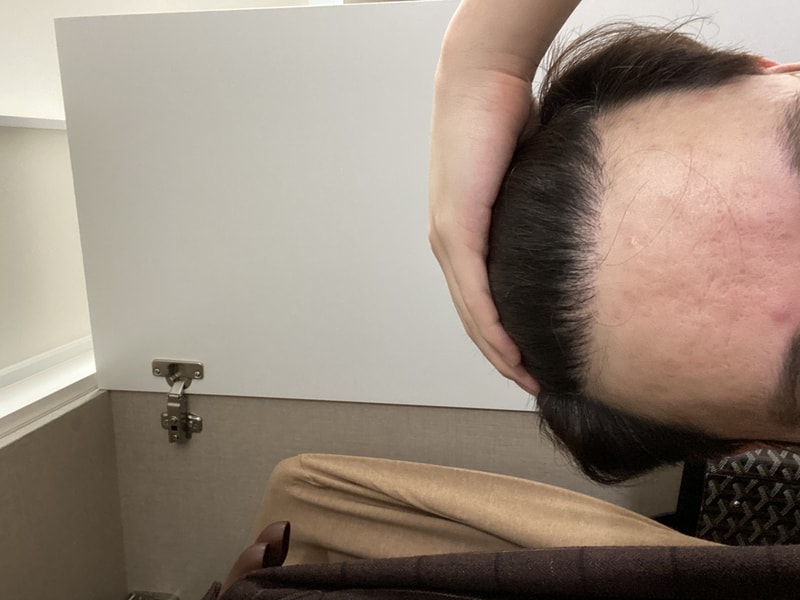 포헤어 비절개 10개월 셀카후기