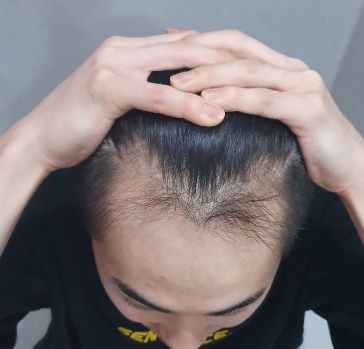 ㅇㄹ홍ㄹ홍롱ㄹ호.jpg