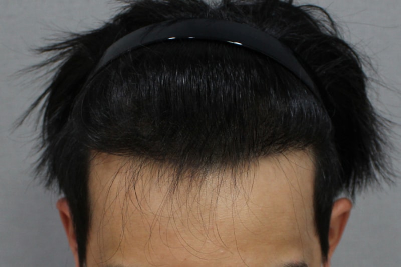 후_19.03.21.jpg