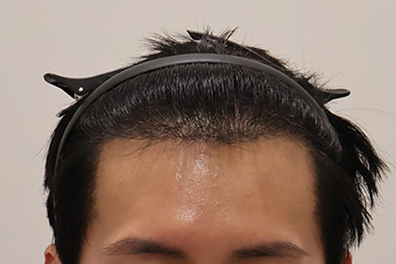 1.png