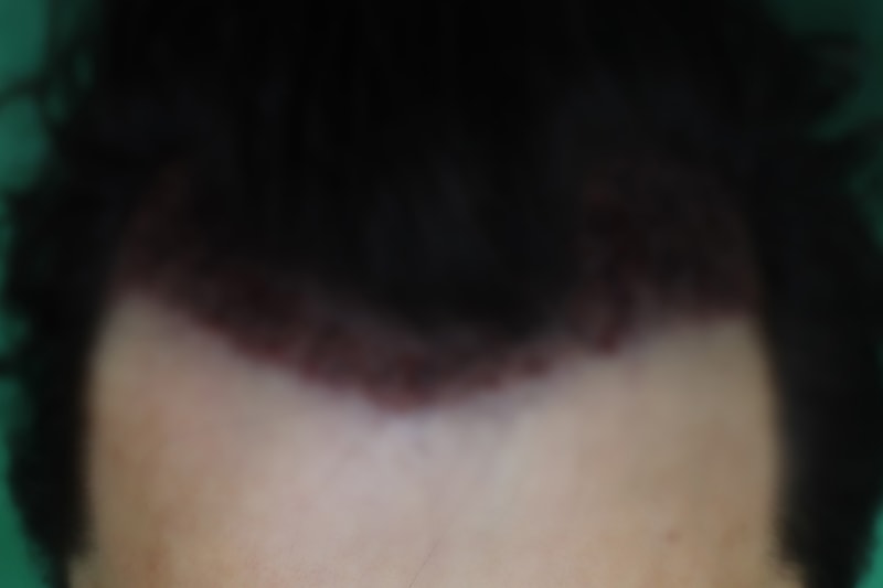 A1.jpg