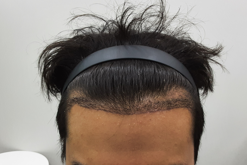 1.png