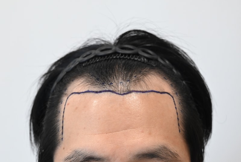 수술전1.jpg