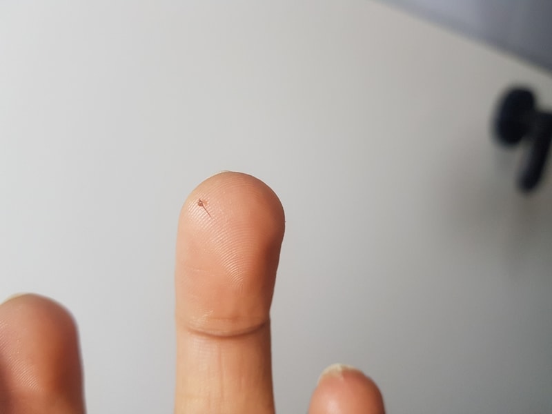 이식모가 빠지는 건가요?