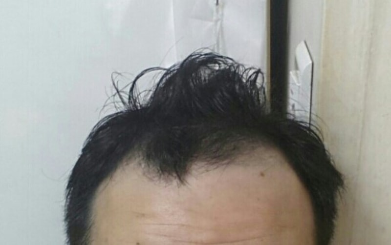 1년차 후기