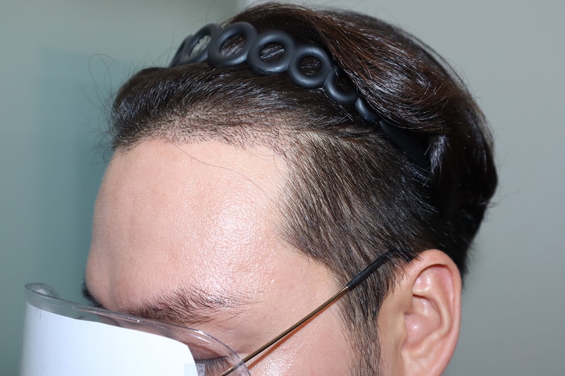 수술후2.jpg