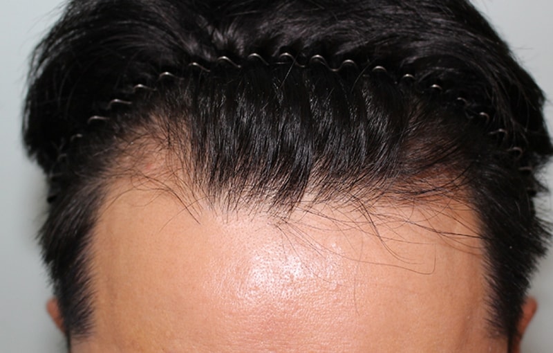 수술전 (7).JPG
