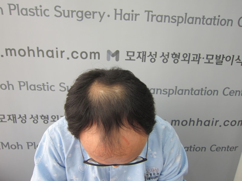 수술 전.JPG