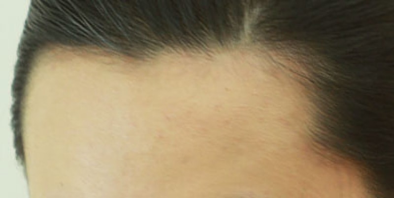 1_수술전 (6).JPG