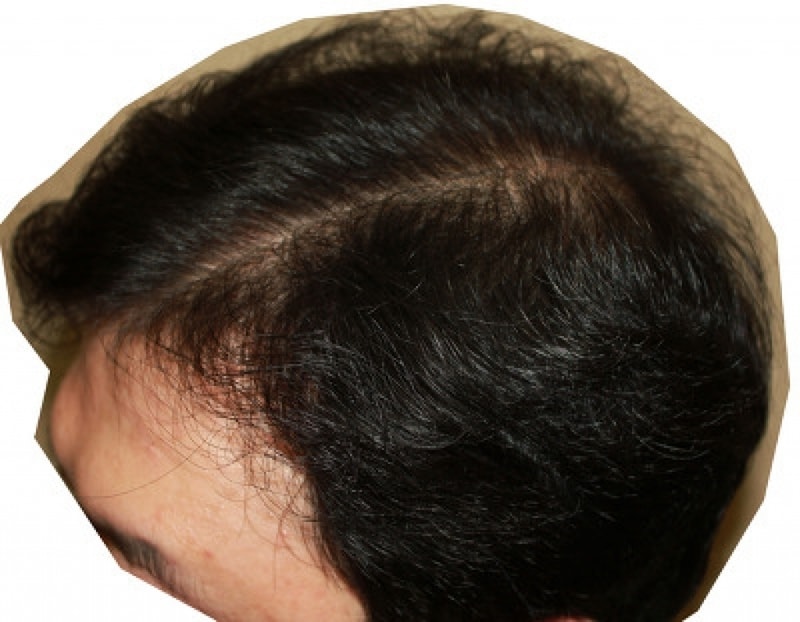 현재 (1).png