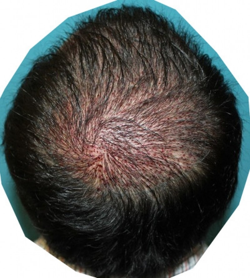 일주일 (1).png