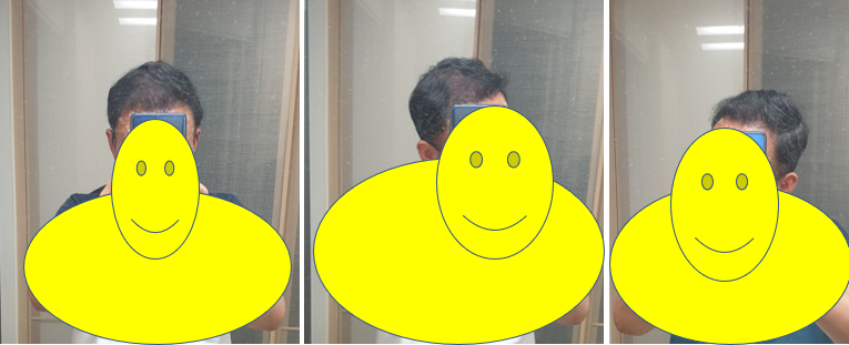 빗질후정면측면.PNG