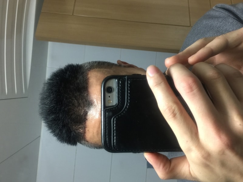 오늘 9일차 입니다 (1).jpg