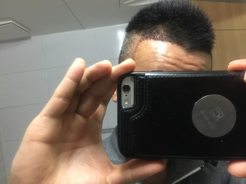오늘 9일차 입니다 (2).jpg