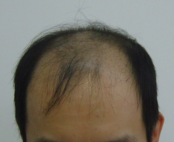 SNC10042.JPG